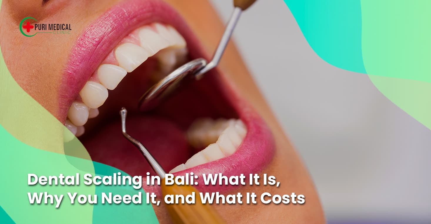 Dental Scaling in Bali
